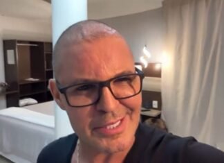 Eduardo Costa assusta a web ao surgir careca: “Usei muito anabolizante no passado”