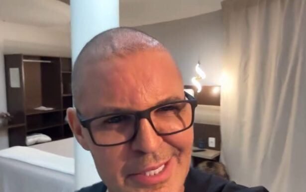 Eduardo Costa assusta a web ao surgir careca: “Usei muito anabolizante no passado”