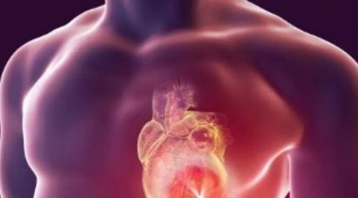 Casos de infarto em jovens disparam e já ultrapassam 234 mil no Brasil