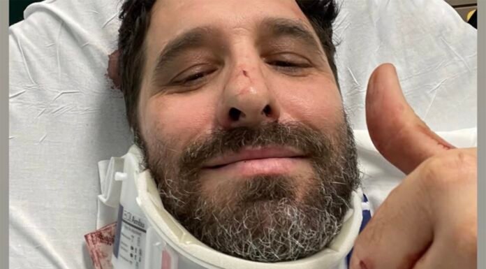 “Apaguei no meio da rua”, revela Rafinha Bastos após acidente