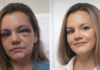Após Agressão Brutal, Juliana Garcia Revela Resultados de Reconstrução Facial