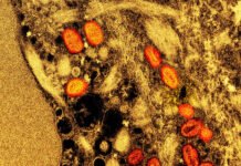 Brasil Registra 136 Casos de Mpox: Novos Estados e Vigilância Aumentada