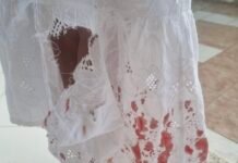 Ataque de Cães de Rua em Petrolina Gera Alarme entre Moradores