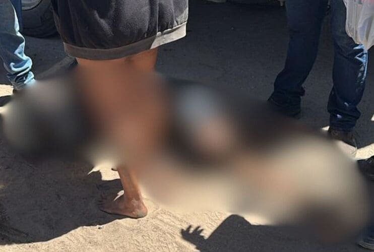 Acidente entre moto e caminhão deixa motociclista ferido em Petrolina