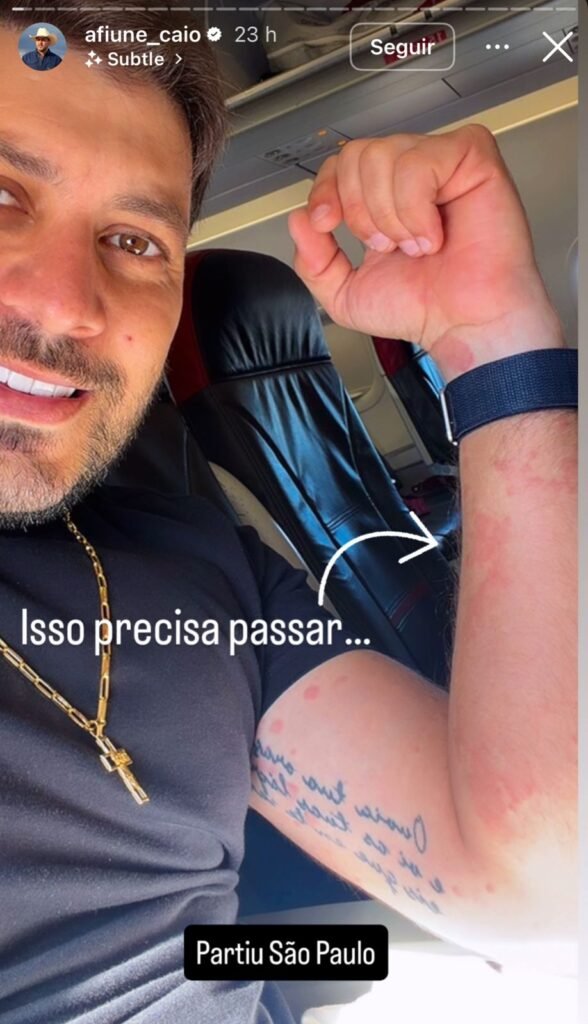 Ex-bbb Caio Afiune enfrenta crise alérgica durante voo e preocupa fãs