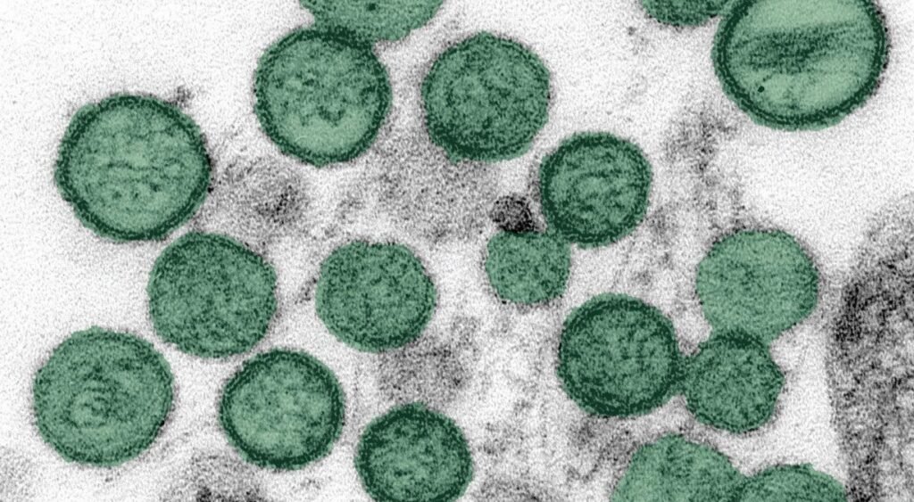Infectologista descarta risco de pandemia por hantavírus