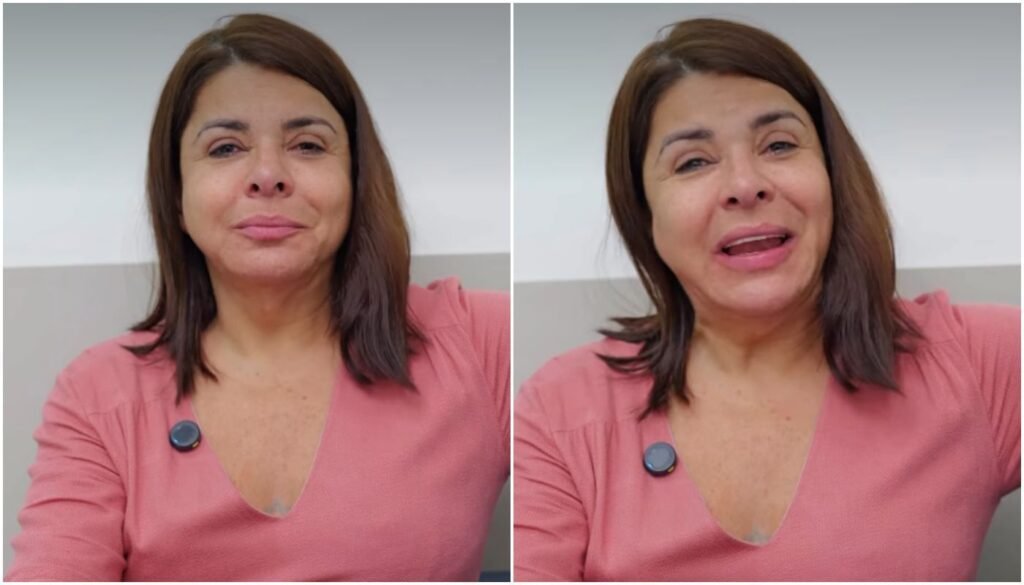 Mara Maravilha revela transformação após lifting facial