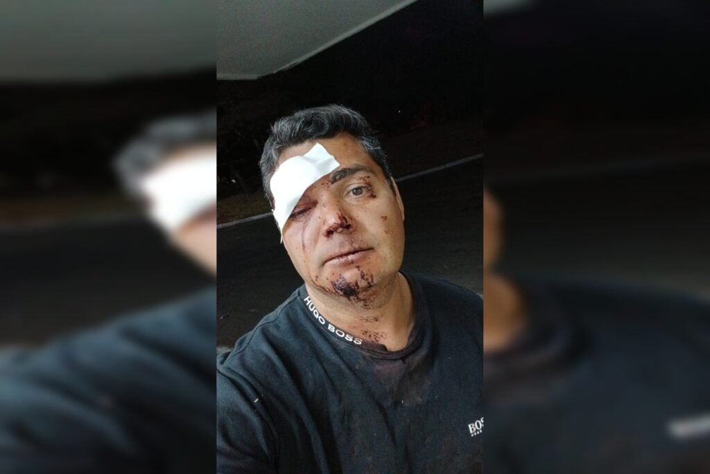 Conflito em bar de Sobradinho deixa irmãos feridos