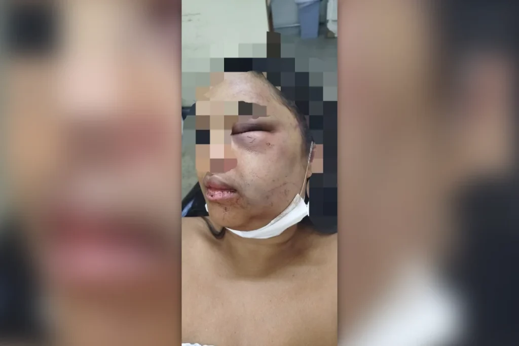 Violência doméstica em Planaltina: mulher denuncia agressor após ataque brutal