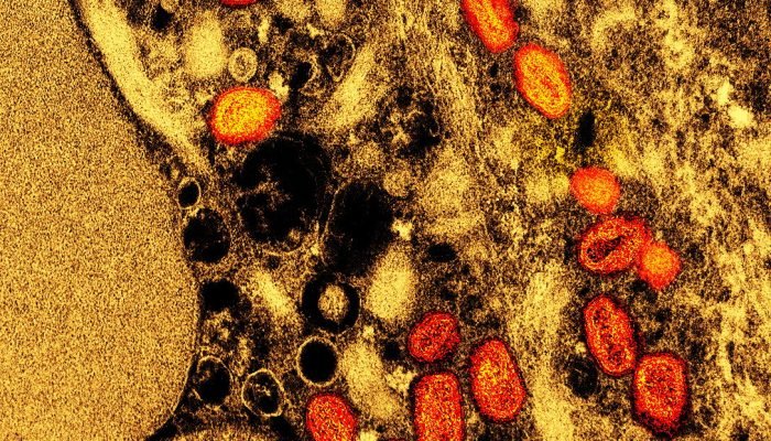 Micrografia eletrônica de transmissão colorida de partículas do vírus mpox capturadas no NIAI...