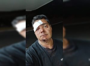 Conflito em bar de Sobradinho deixa irmãos feridos