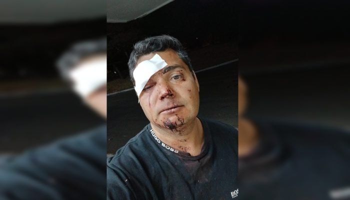 Conflito em bar de Sobradinho deixa irmãos feridos