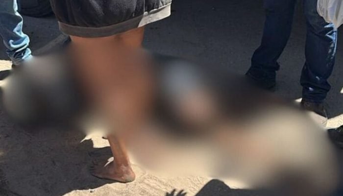 Acidente entre moto e caminhão deixa motociclista ferido em Petrolina