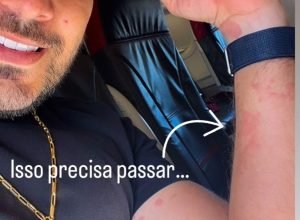Ex-bbb Caio Afiune enfrenta crise alérgica durante voo e preocupa fãs