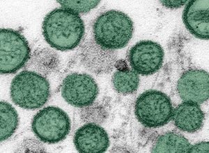 Infectologista descarta risco de pandemia por hantavírus