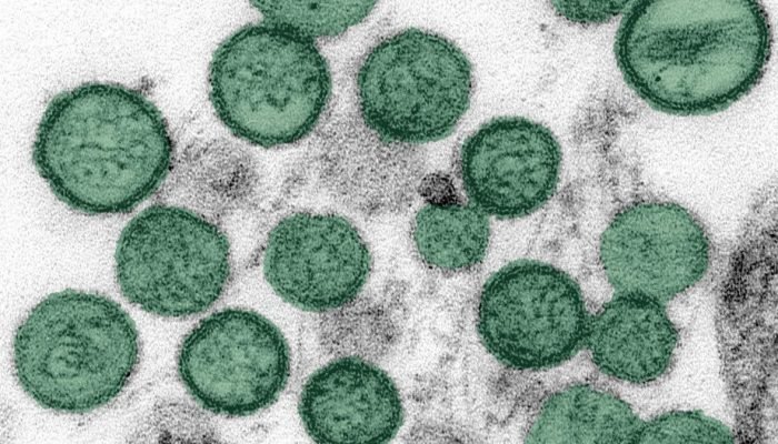 Infectologista descarta risco de pandemia por hantavírus