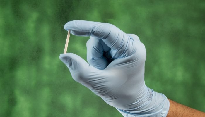 Controvérsias sobre implantes hormonais e restrições do CFM