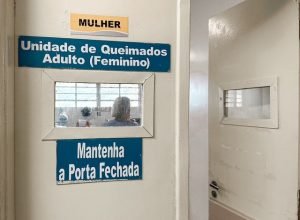 Hospital reforça cuidados contra queimaduras nas festas juninas