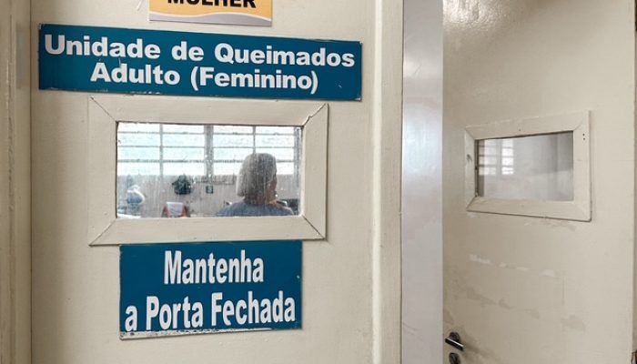 Hospital reforça cuidados contra queimaduras nas festas juninas