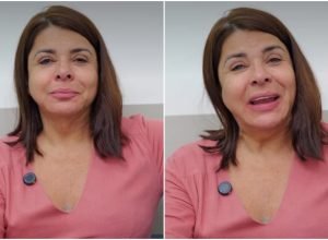Mara Maravilha revela transformação após lifting facial