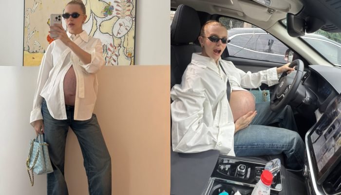 Isa Scherer brinca sobre gravidez prolongada e diverte seguidores