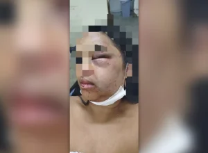 Violência doméstica em Planaltina: mulher denuncia agressor após ataque brutal